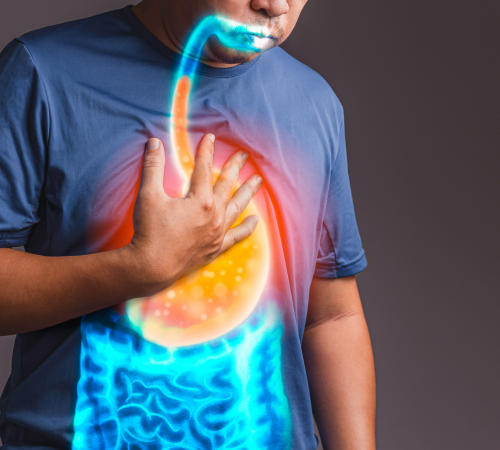 Acid Reflux Surgery